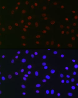 Invitrogen USP39 Recombinant Rabbit Monoclonal Antibody (1S9R9) 100 &mu;L;