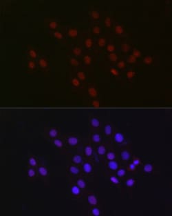 Invitrogen USP39 Recombinant Rabbit Monoclonal Antibody (1S9R9) 100 &mu;L;