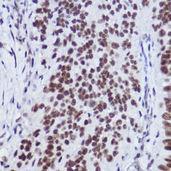 Invitrogen USP39 Recombinant Rabbit Monoclonal Antibody (1S9R9) 100 &mu;L;