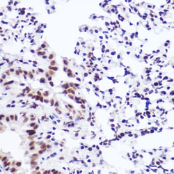 Invitrogen USP39 Recombinant Rabbit Monoclonal Antibody (1S9R9) 100 &mu;L;