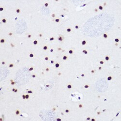 Invitrogen USP39 Recombinant Rabbit Monoclonal Antibody (1S9R9) 100 &mu;L;