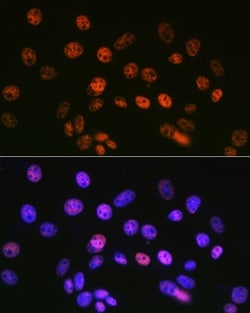 Invitrogen SIN3A Recombinant Rabbit Monoclonal Antibody (8V5B6) 100 &mu;L;