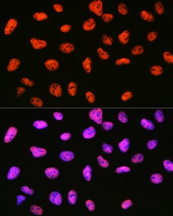 Invitrogen SIN3A Recombinant Rabbit Monoclonal Antibody (8V5B6) 100 &mu;L;