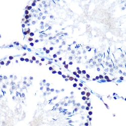 Invitrogen SIN3A Recombinant Rabbit Monoclonal Antibody (8V5B6) 100 &mu;L;
