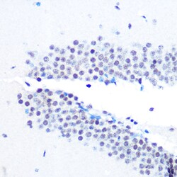 Invitrogen SIN3A Recombinant Rabbit Monoclonal Antibody (8V5B6) 100 &mu;L;
