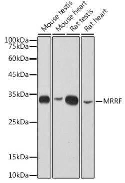 MRRF Recombinant Rabbit Monoclonal Antibody (1T5W1), Invitrogen&trade;