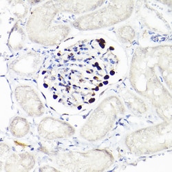 Invitrogen WT1 Recombinant Rabbit Monoclonal Antibody (6L9X6) 100 &mu;L;