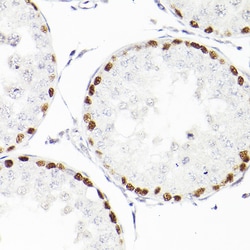 Invitrogen WT1 Recombinant Rabbit Monoclonal Antibody (6L9X6) 100 &mu;L;