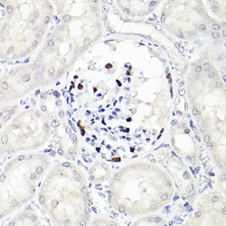 Invitrogen WT1 Recombinant Rabbit Monoclonal Antibody (6L9X6) 100 &mu;L;