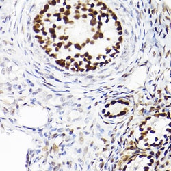 Invitrogen WT1 Recombinant Rabbit Monoclonal Antibody (6L9X6) 100 &mu;L;