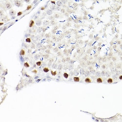 Invitrogen WT1 Recombinant Rabbit Monoclonal Antibody (6L9X6) 100 &mu;L;