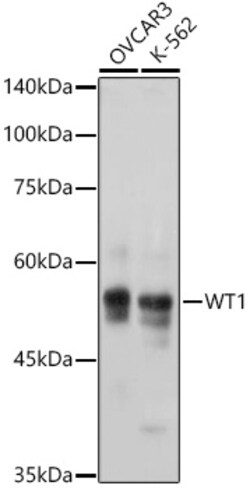 Invitrogen WT1 Recombinant Rabbit Monoclonal Antibody (6L9X6) 100 &mu;L;
