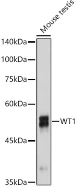 Invitrogen WT1 Recombinant Rabbit Monoclonal Antibody (6L9X6) 100 &mu;L;