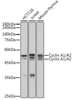 Invitrogen Cyclin A1/A2 Recombinant Rabbit Monoclonal Antibody (10O1C8) 100 &mu;L | Buy Online | Invitrogen&trade; | Fisher Scientific