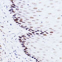 Invitrogen p73 Recombinant Rabbit Monoclonal Antibody (7L1V7) 100 &mu;L;