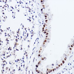 Invitrogen p73 Recombinant Rabbit Monoclonal Antibody (7L1V7) 100 &mu;L;