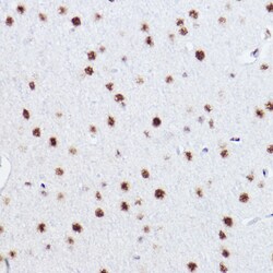 Invitrogen p73 Recombinant Rabbit Monoclonal Antibody (7L1V7) 100 &mu;L;