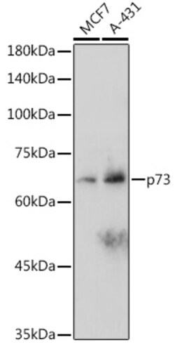Invitrogen p73 Recombinant Rabbit Monoclonal Antibody (7L1V7) 100 &mu;L;