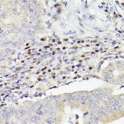 Invitrogen MEF2A/MEF2C Recombinant Rabbit Monoclonal Antibody (10I9G9)