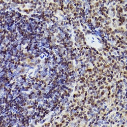 Invitrogen MEF2A/MEF2C Recombinant Rabbit Monoclonal Antibody (10I9G9)