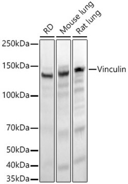 Invitrogen Vinculin Recombinant Rabbit Monoclonal Antibody (9I3Y8) 100