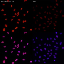 Invitrogen H3K27ac Recombinant Rabbit Monoclonal Antibody (2V10N10) 100