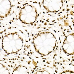 Invitrogen H3K27ac Recombinant Rabbit Monoclonal Antibody (2V10N10) 100