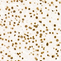 Invitrogen H3K27ac Recombinant Rabbit Monoclonal Antibody (2V10N10) 100