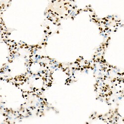 Invitrogen H3K27ac Recombinant Rabbit Monoclonal Antibody (2V10N10) 100