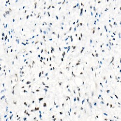 Invitrogen SMARCB1 Recombinant Rabbit Monoclonal Antibody (9A9G0) 100 &mu;L;