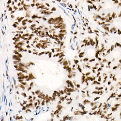 Invitrogen SMARCB1 Recombinant Rabbit Monoclonal Antibody (9A9G0) 100 &mu;L;