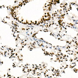 Invitrogen SMARCB1 Recombinant Rabbit Monoclonal Antibody (9A9G0) 100 &mu;L;