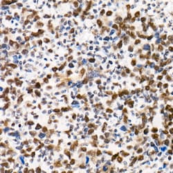 Invitrogen SMARCB1 Recombinant Rabbit Monoclonal Antibody (9A9G0) 100 &mu;L;