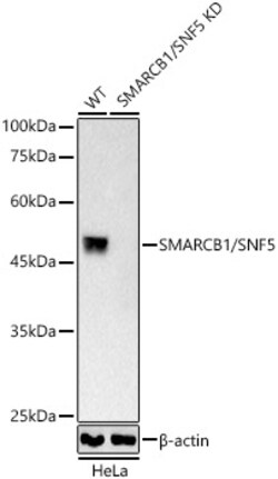 Invitrogen SMARCB1 Recombinant Rabbit Monoclonal Antibody (9A9G0) 100 &mu;L;