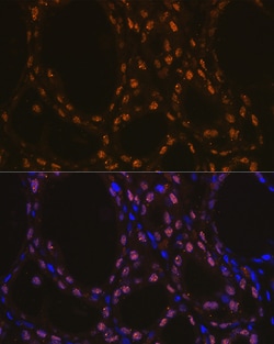 Invitrogen Nkx2.1 Recombinant Rabbit Monoclonal Antibody (3O2N3) 100 &mu;L | Buy Online | Invitrogen&trade; | Fisher Scientific