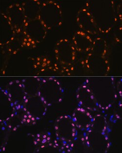 Invitrogen Nkx2.1 Recombinant Rabbit Monoclonal Antibody (3O2N3) 100 &mu;L | Buy Online | Invitrogen&trade; | Fisher Scientific
