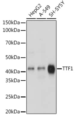 Invitrogen Nkx2.1 Recombinant Rabbit Monoclonal Antibody (3O2N3) 100 &mu;L | Buy Online | Invitrogen&trade; | Fisher Scientific
