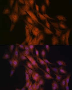 Invitrogen GLI3 Recombinant Rabbit Monoclonal Antibody (8B1E2) 100 &mu;L | Buy Online | Invitrogen&trade; | Fisher Scientific