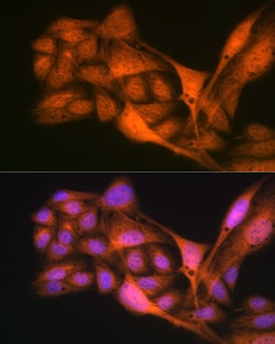 Invitrogen GLI3 Recombinant Rabbit Monoclonal Antibody (8B1E2) 100 &mu;L | Buy Online | Invitrogen&trade; | Fisher Scientific
