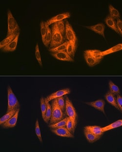Invitrogen TAB1 Recombinant Rabbit Monoclonal Antibody (2W0P2) 100 &mu;L;