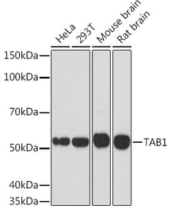 Invitrogen TAB1 Recombinant Rabbit Monoclonal Antibody (2W0P2) 100 &mu;L;