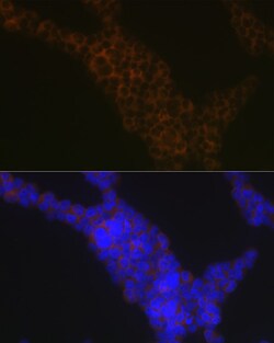 Invitrogen LSP1 Recombinant Rabbit Monoclonal Antibody (4U10N5) 100 &mu;L | Buy Online | Invitrogen&trade; | Fisher Scientific