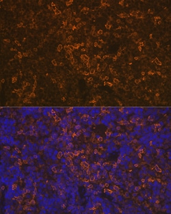 Invitrogen LSP1 Recombinant Rabbit Monoclonal Antibody (4U10N5) 100 &mu;L | Buy Online | Invitrogen&trade; | Fisher Scientific