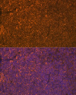 Invitrogen LSP1 Recombinant Rabbit Monoclonal Antibody (4U10N5) 100 &mu;L | Buy Online | Invitrogen&trade; | Fisher Scientific