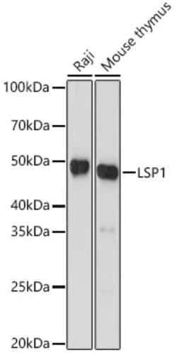 Invitrogen LSP1 Recombinant Rabbit Monoclonal Antibody (4U10N5) 100 &mu;L | Buy Online | Invitrogen&trade; | Fisher Scientific