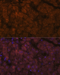 Invitrogen ADAMTS13 Recombinant Rabbit Monoclonal Antibody (7B2Z8) 100