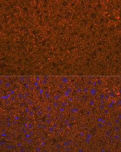 Invitrogen ADAMTS13 Recombinant Rabbit Monoclonal Antibody (7B2Z8) 100