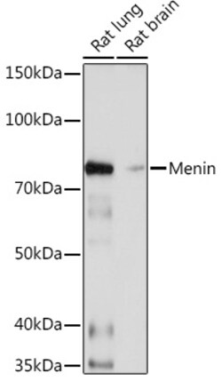 Invitrogen Menin Recombinant Rabbit Monoclonal Antibody (5M7L9) 100 &mu;L;