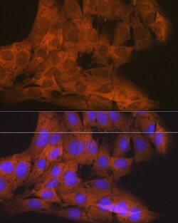 Invitrogen TBK1 Recombinant Rabbit Monoclonal Antibody (4G6C7) 100 &mu;L;