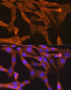 Invitrogen TBK1 Recombinant Rabbit Monoclonal Antibody (4G6C7) 100 &mu;L;